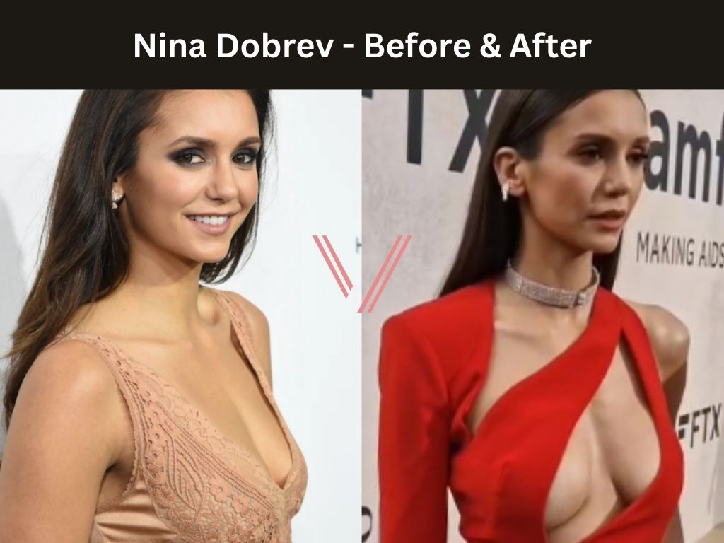akasha vamp recommends nina dobrev boobs dimitris marantidis add Ebony jada fire photo