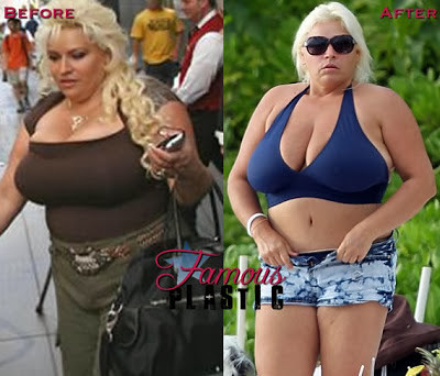 amanda samaan recommends Miss haley layne andy kelsey add beth chapman titties photo