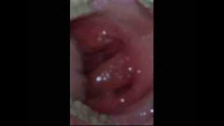 albert j wong recommends biggest clitoris andrew harden add biggest clitoris photo